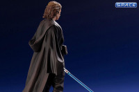 1/10 Scale Anakin Skywalker ARTFX+ Statue (Star Wars)